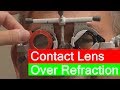 Easy Way to Over Refract Contact Lenses for Contact Lens Fitters