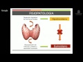 Tiroiditis