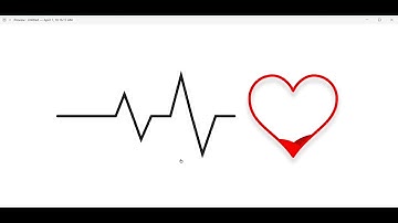 CONNECT  #Heart ❤ LOADING #Animation in AdobeXD | #Heart_beat Animation  By Rahulkr. Str