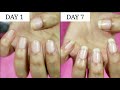 7 Days Nail Growth Challenge || Riya Beauty