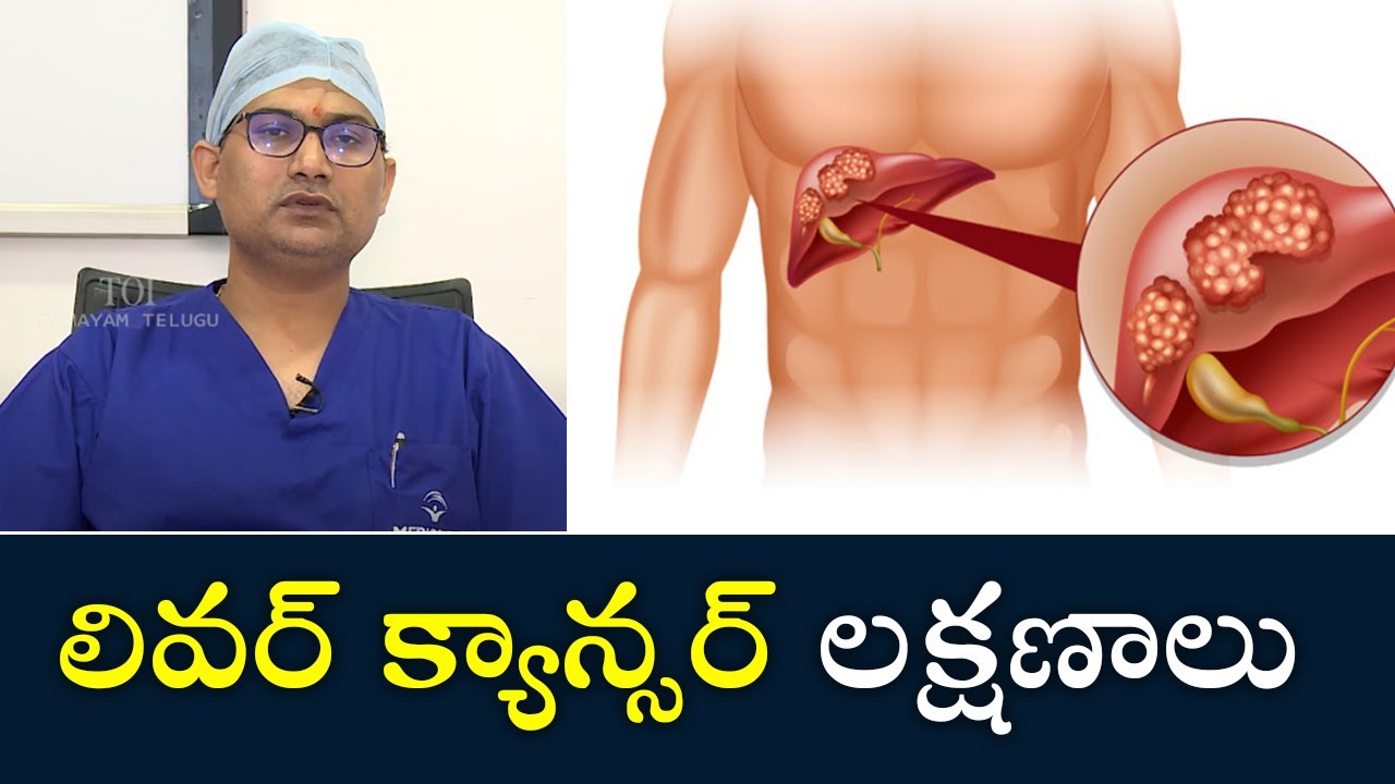 Symptoms of Liver Cancer | లివర్ క్యాన్సర్ లక్షణాలు | Samayam Telugu