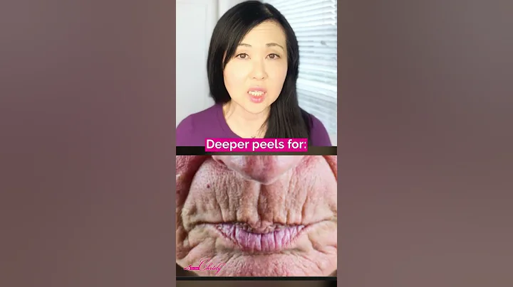 DO This FIRST BEFORE doing a Deep Chemical Peel #Shorts