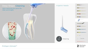 ProTaper Ultimate Endo File System - Cleaning Sequence