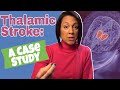Thalamic Stroke Recovery Program