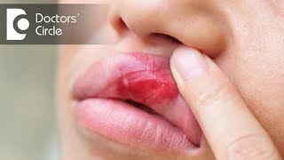 Surgeries to correct uneven upper lip due to an injury? - Dr. Srikanth V