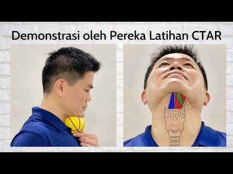 Latihan Menelan (Dysphagia) Chin Tuck Against Resistance / CTAR dengan Bola Getah (B Melayu / Malay)