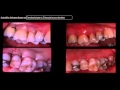 Éric Rompen "Actualités thérapeutiques en parodontologie et chirurgie bucco-dentaire"