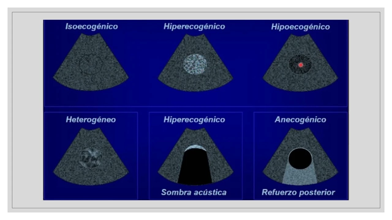 ABC de diagnostico por imágenes
