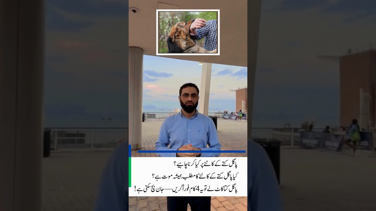 Rabies Exam Key Points  vaccination Procedure Dr Hafiz Atif  First Aid Made Easy Platform #FCPS #NRE
