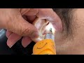 【床屋の耳掃除】おばあちゃん 男性モデル 耳洗潔COOL 綿棒 2022.6