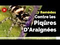  7 remdes naturels pour soigner les piqres daraignes 