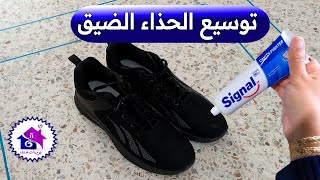 توسيع الحذاء الضيق ♻️ حيل لتكبير الاحذية الضيقة (بدون تعب)