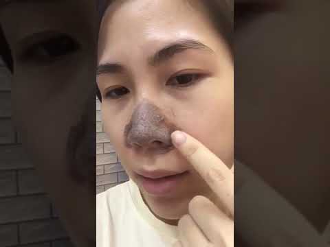 Review mặt nạ - kem lấy mụn đầu đen thu nhỏ lỗ chân TSURURI Nhật Bản