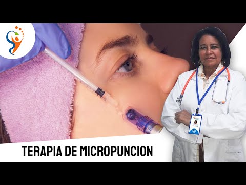 TERAPIA DE MICROPUNCION | Dra. Gregoria Guanipa