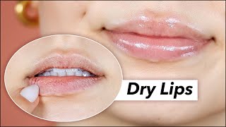 I'mma fix those dry lips