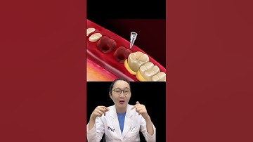 Giải thích video về răng #shorts