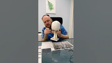 Первый шейный позвонок человека