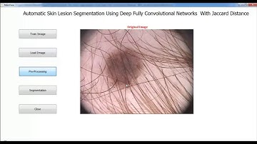 Automatic Skin Lesion Segmentation Using Deep Fully Convolutional Network Projects