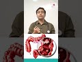 నిద్రలేమి మీ రోగనిరోధక శక్తిని దెబ్బతీస్తుంది...తెలుసా? | Sleep & Immunity | Dr. Shashidhar Manchala