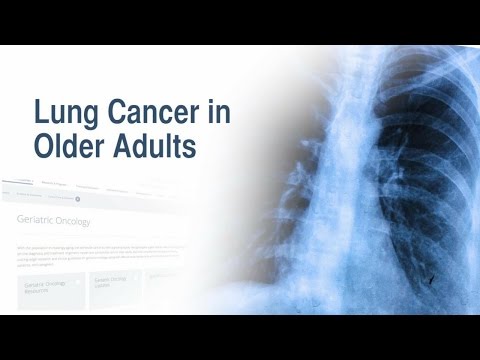Lung Cancer in Older Adults