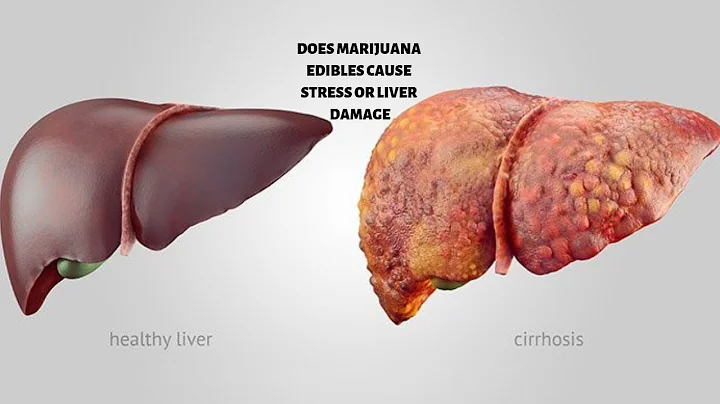 Does edible marijuana stress or damage the liver?