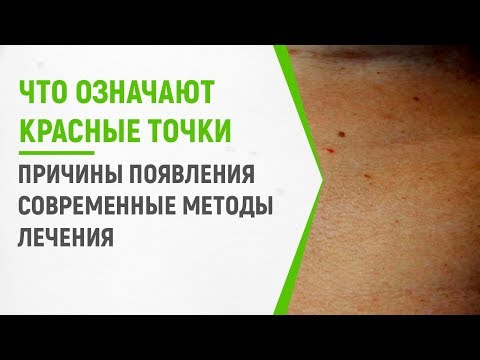 Что означают красные точки на теле, причины появления