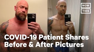 Battling COVID-19: Before and After Pictures | NowThis