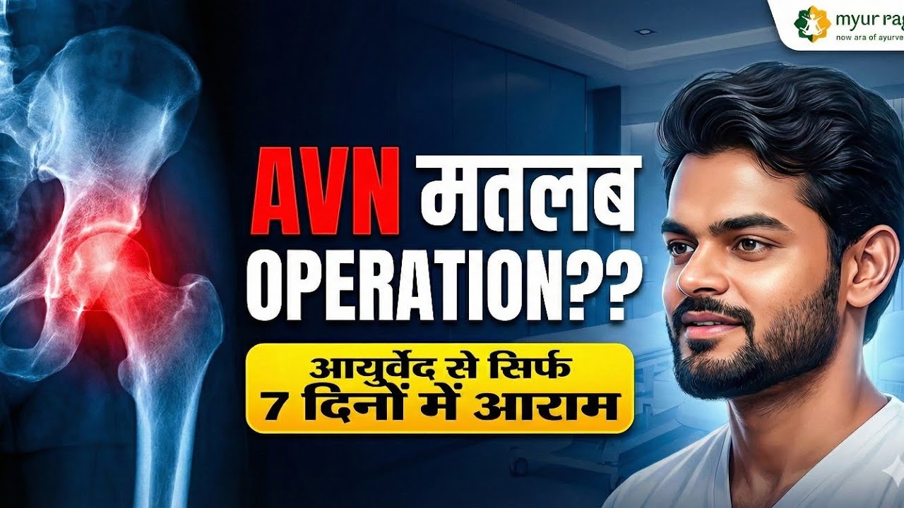 AVN grade 2 treatment without operation Ayurvedic 
