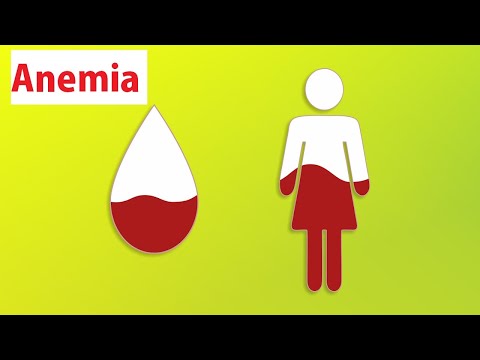 Anemia | Anemia Akibat Kekurangan Zat Besi | Uncinariasis