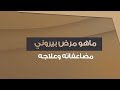 كيف يتم تشخيص وعلاج مرض بيروني وعلاقته ب الضعف الجنسي مع د محمد هنداوي استشاري امراض الذكورة