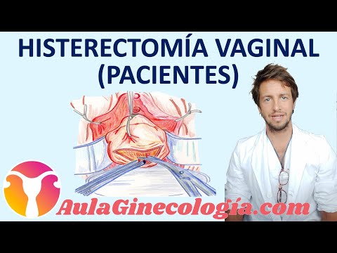 Video: ¿Qué significa colpopexia en términos médicos?