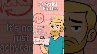 How to Identify Atrial Flutter on an EKG