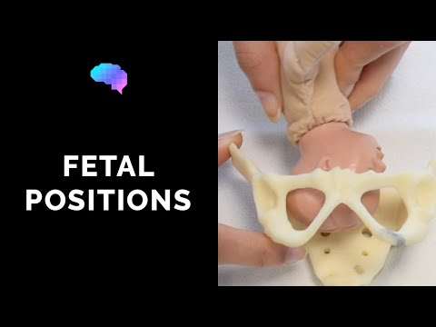 Video: Wat is de positie van de foetus?