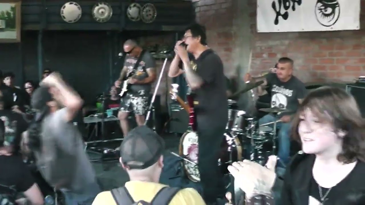 Cirrosis - 16 Alcohol