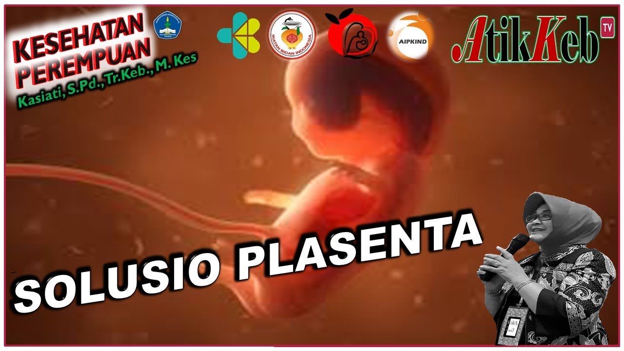 ASUHAN IBU HAMIL DENGAN SOLUSIO PLASENTA ||| #KupasTuntas #EdukasiUntukNegeri #KEBIDANAN #BIDAN
