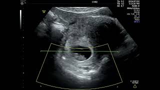 8 weeks \& 2 days (Ji Min)