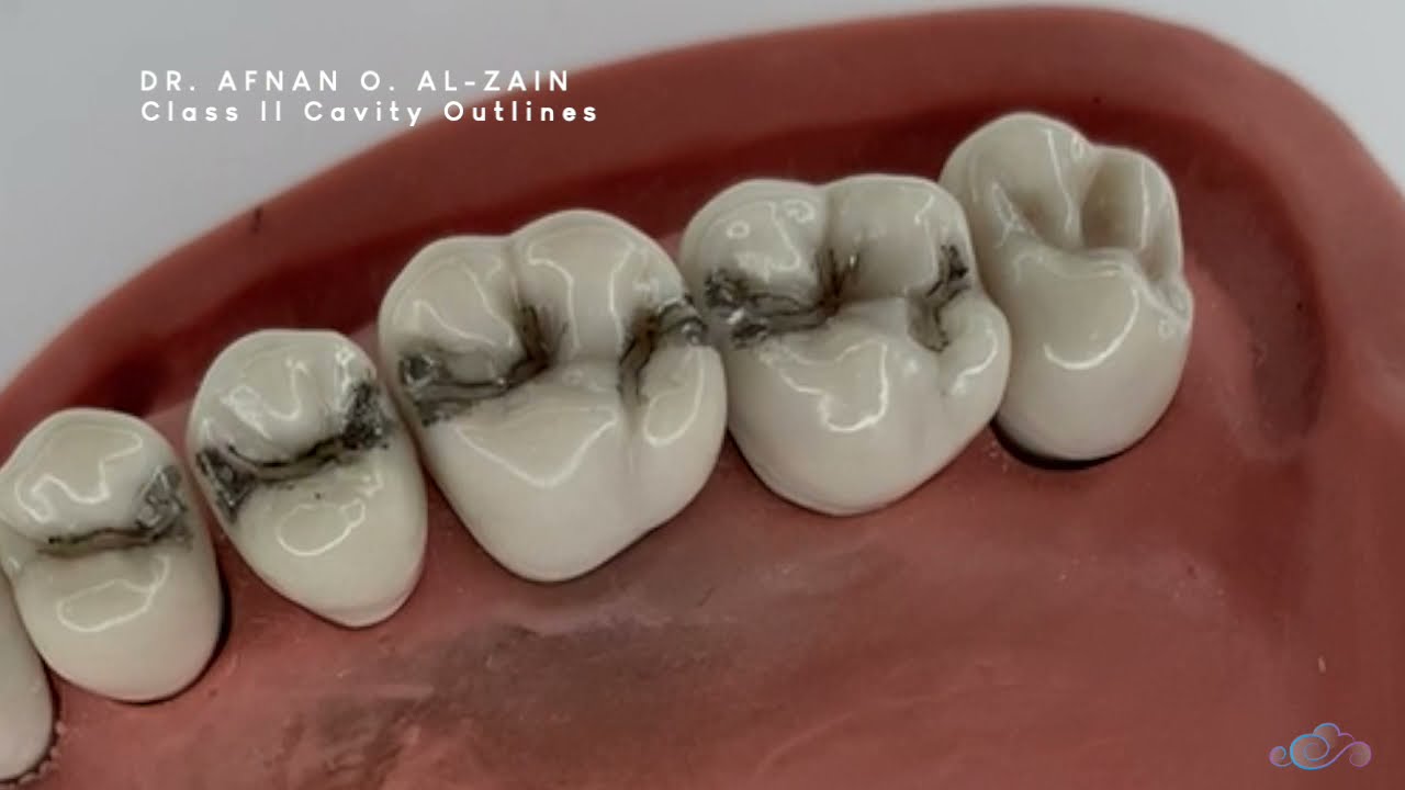 Class II cavity preparation for amalgam - mandibular molar #36 -  Preclinical Operative - Arabic عربي 