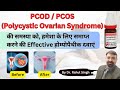 PCOS/PCOD का इलाज होम्योपैथी से | कारण, लक्षण और प्रभावी उपचार | PCOD/PCOS Treatment in Hindi