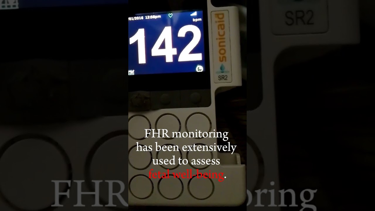 #fetaldoppler