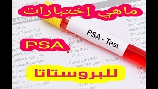 البروستاتا -- ما هو إختبار PSA