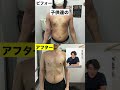 アトピー性皮膚炎の痒みを抑える!効果的なスキンケア術と生活改善方法#shorts