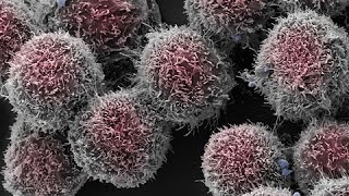 The Future of Cancer: Prevention and Precision Medicine