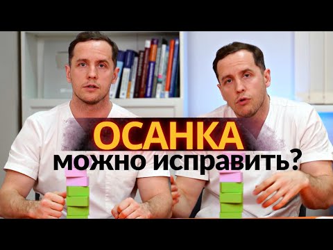 Как исправить ОСАНКУ | Вправление позвонков - миф?