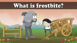 What is frostbite? | #aumsum #kids #science #education #children