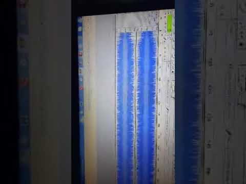 أنتي لوف السنين ريميكس  