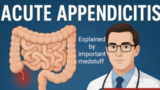 Acute Appendicitis | First Aid USMLE Step 1 & NRE-1 High-Yield Explanation