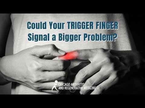Could Your Trigger Finger Signal a Bigger Problem?