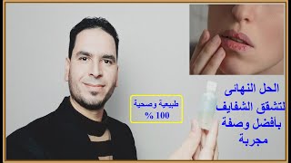 افضل وصفة للقضاء على تشقق الشفاه ( الشفايف ) نهائيا  بطريقة طبيعية وصحية 100 %