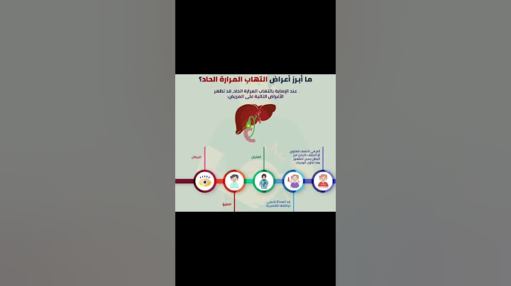 أعراض التهاب المرارة الحاد #صحه #ترند #طبيب #طب #doctor