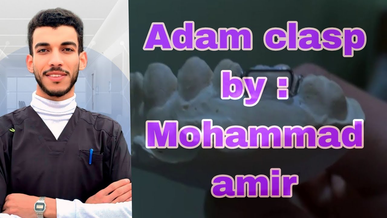 How to make (Adam clasp ) in orthodontics🦷